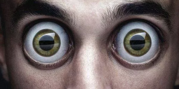 علاج جحوظ العين (انتفاخ العينين) في إيران