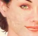 التقلصات