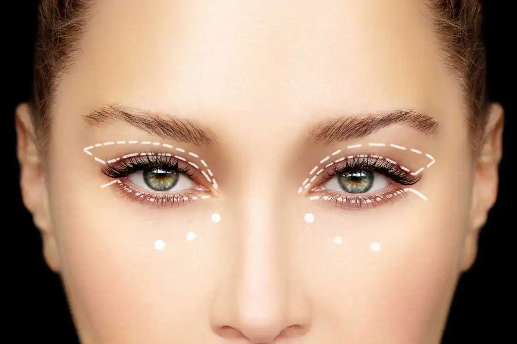 Eyelid Surgery In Iran