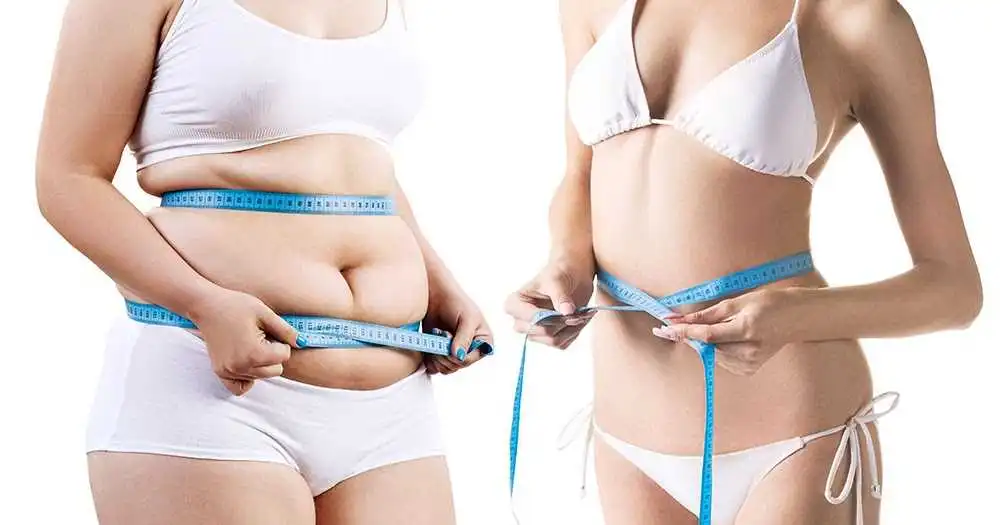 Liposuction in Iran