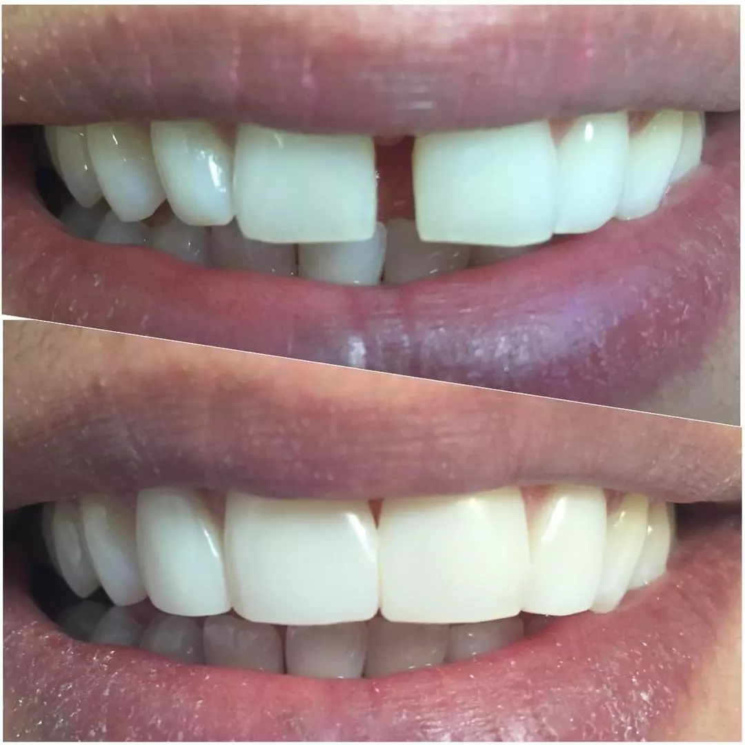 orthodontics in Shiraz City