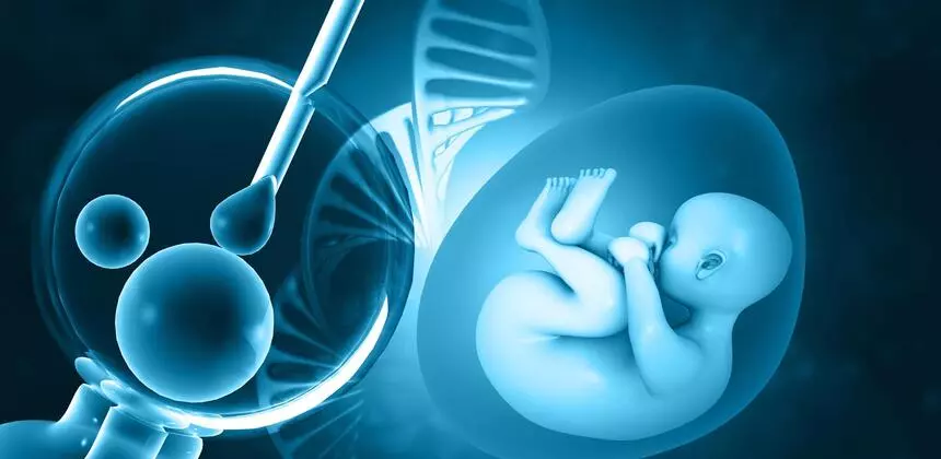IVF in Iran